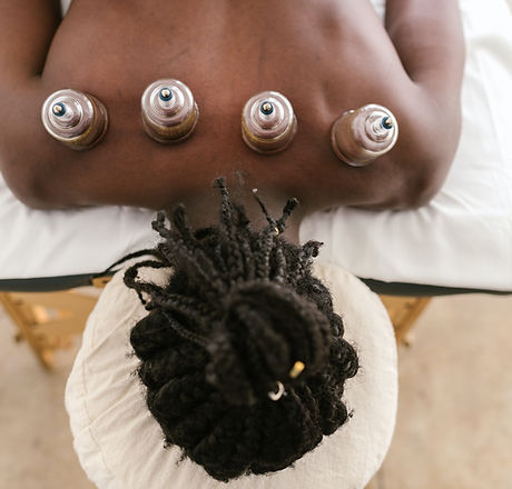 Cupping therapy treatment image